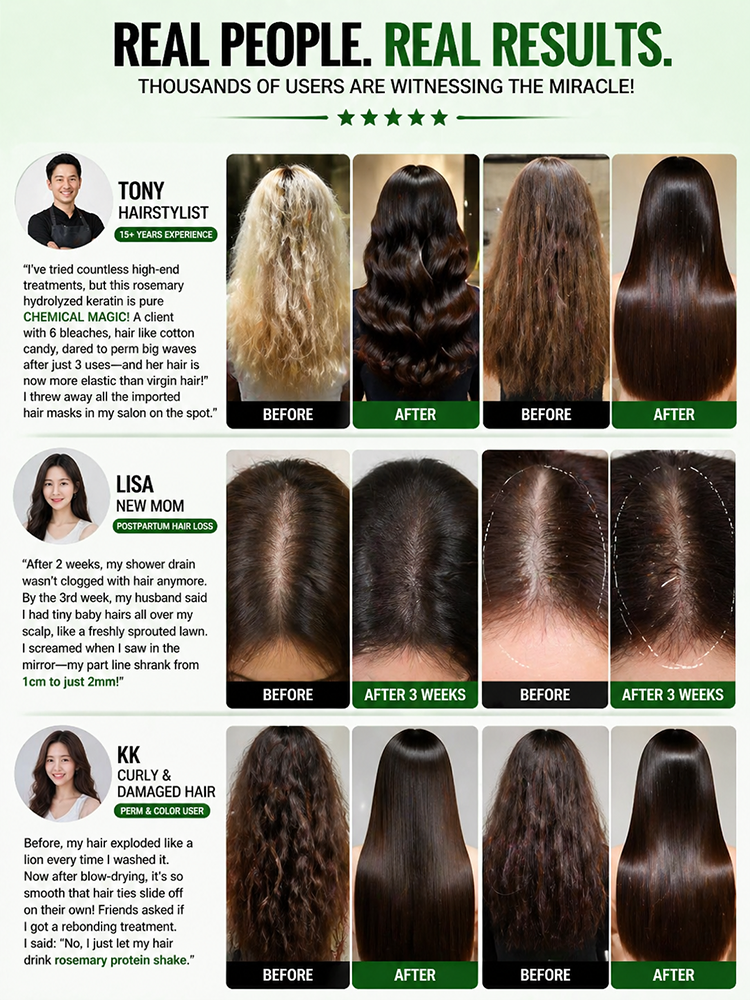 【Hair Loss Fighter - See Results in 7 Days】 Rosemary Herbal Extract Nourishing and Rejuvenating Shampoo
