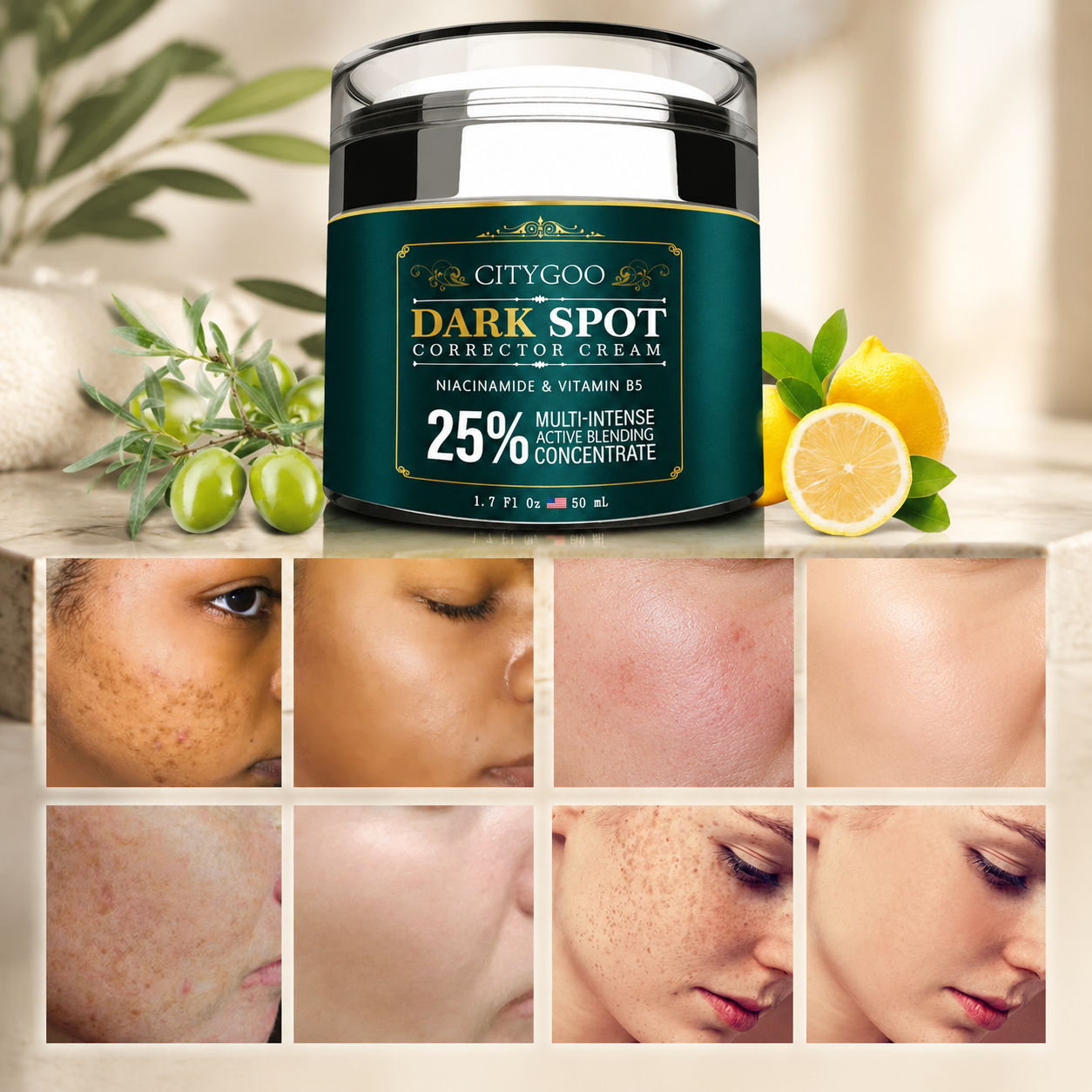 Citygoo Dark Spot Remover Cream – Brighten Skin, Reduce Acne Marks & Uneven Skin Tone, 1.7oz