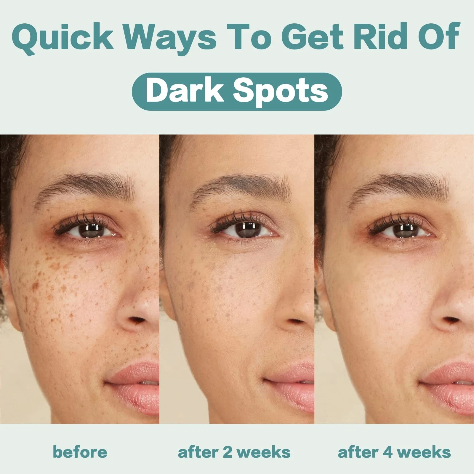 Citygoo Dark Spot Remover Cream – Brighten Skin, Reduce Acne Marks & Uneven Skin Tone, 1.7oz