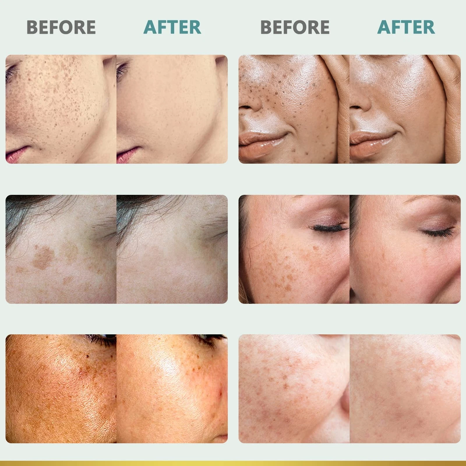Citygoo Dark Spot Remover Cream – Brighten Skin, Reduce Acne Marks & Uneven Skin Tone, 1.7oz
