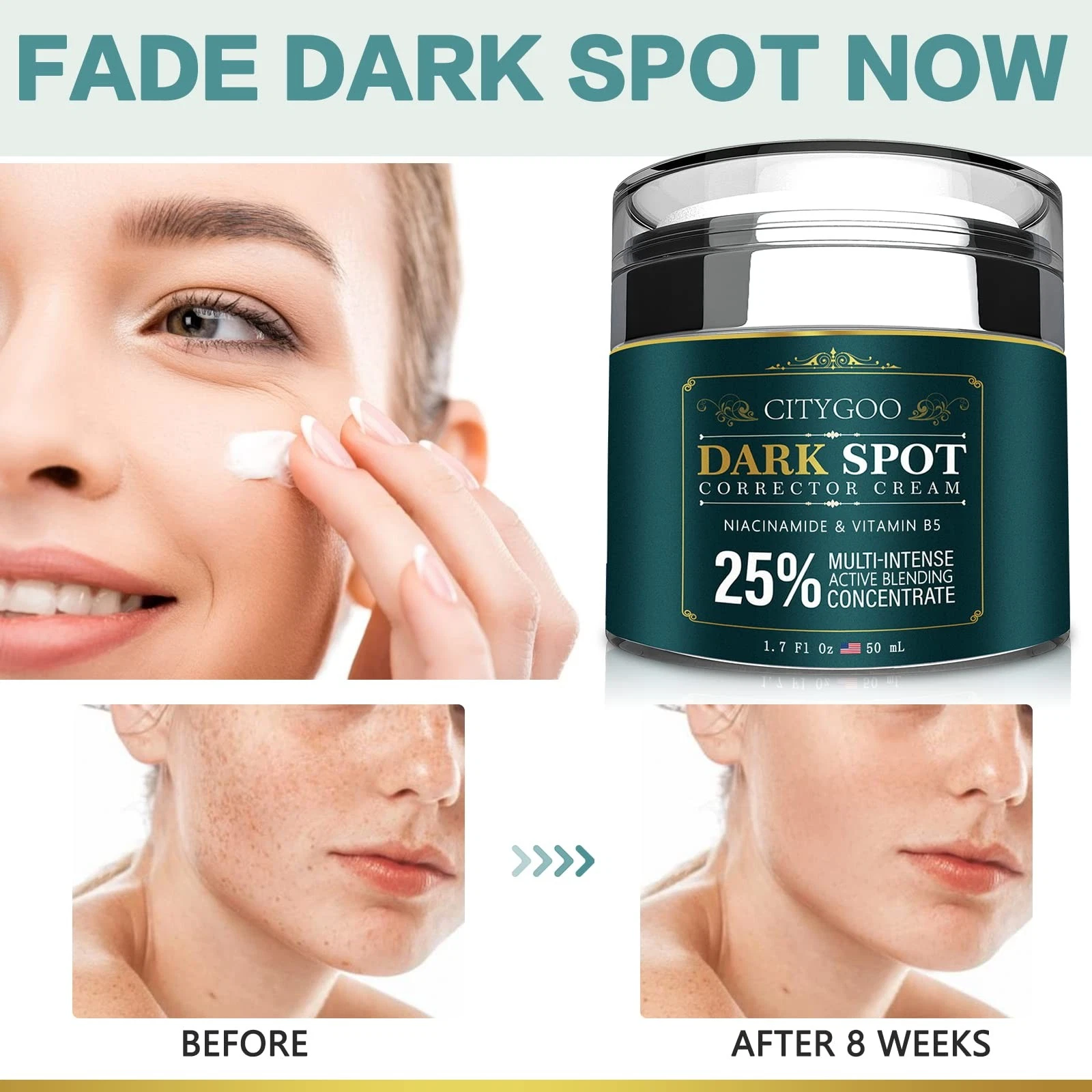 Citygoo Dark Spot Remover Cream – Brighten Skin, Reduce Acne Marks & Uneven Skin Tone, 1.7oz