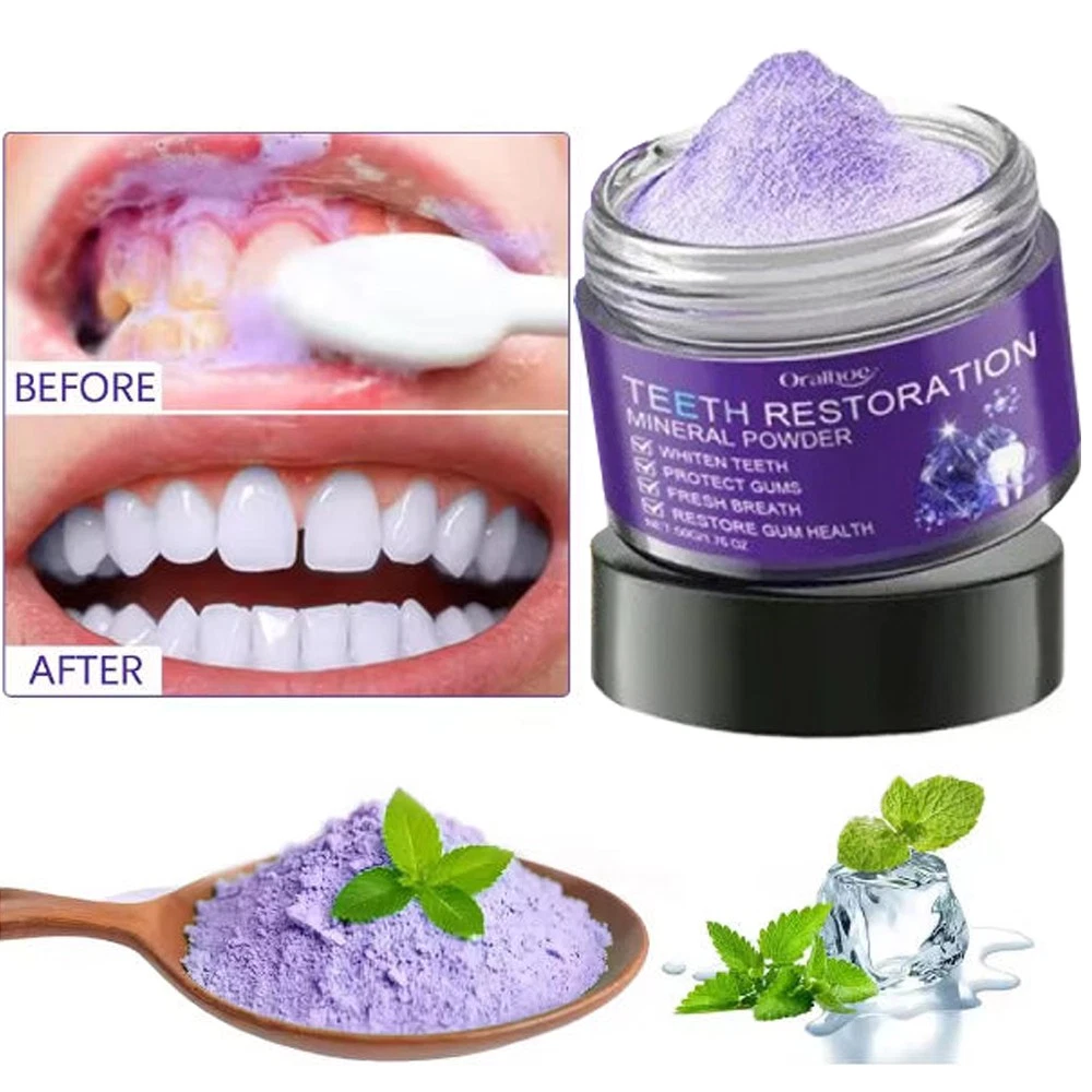 Teeth Whitening Mineral Powder – Natural Teeth Restoration, Protects Gums & Freshens Breath, Vegan, Organic Oral Care, Purple Gentle Mint, Before & After Results
