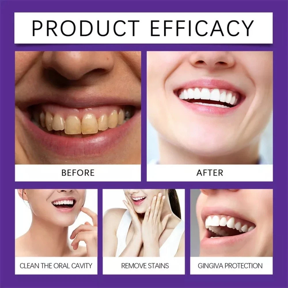 Teeth Whitening Mineral Powder – Natural Teeth Restoration, Protects Gums & Freshens Breath, Vegan, Organic Oral Care, Purple Gentle Mint, Before & After Results