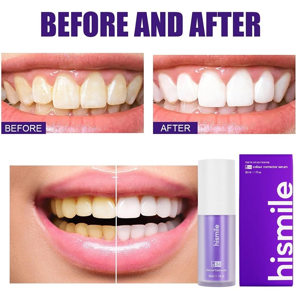 Natural Teeth Whitening Powder – Gentle Oral Care, Fresh Breath & Enamel Protection, Vegan Mineral Formula, Before & After Results, Smile Brightener
