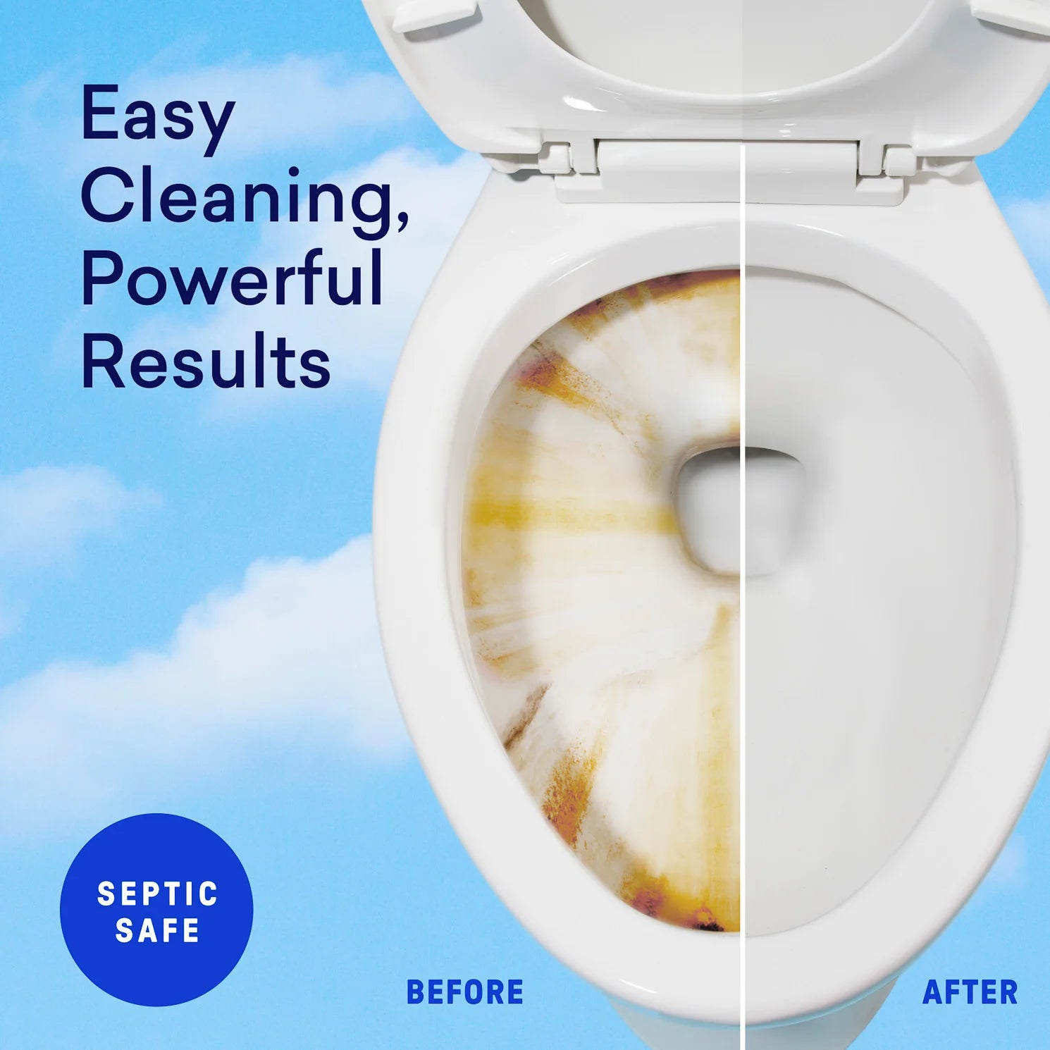 Toilet Bowl Cleaner Starter Set