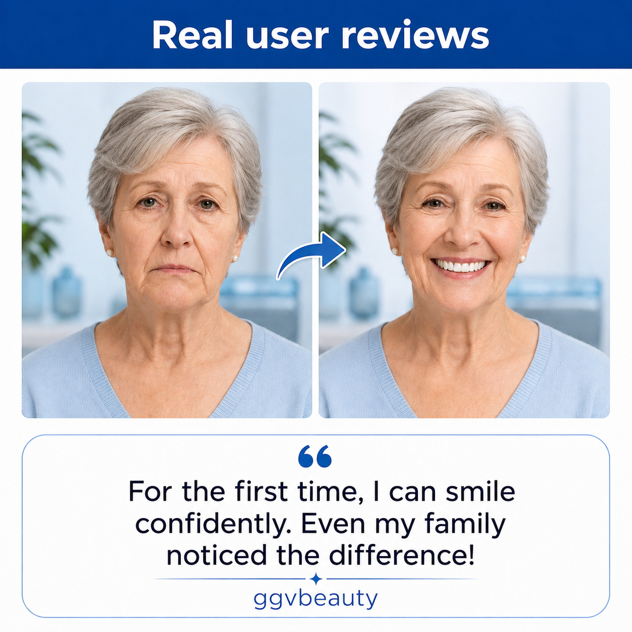 Lace and Lush Custom-Fit Dentures for Everyday Comfort