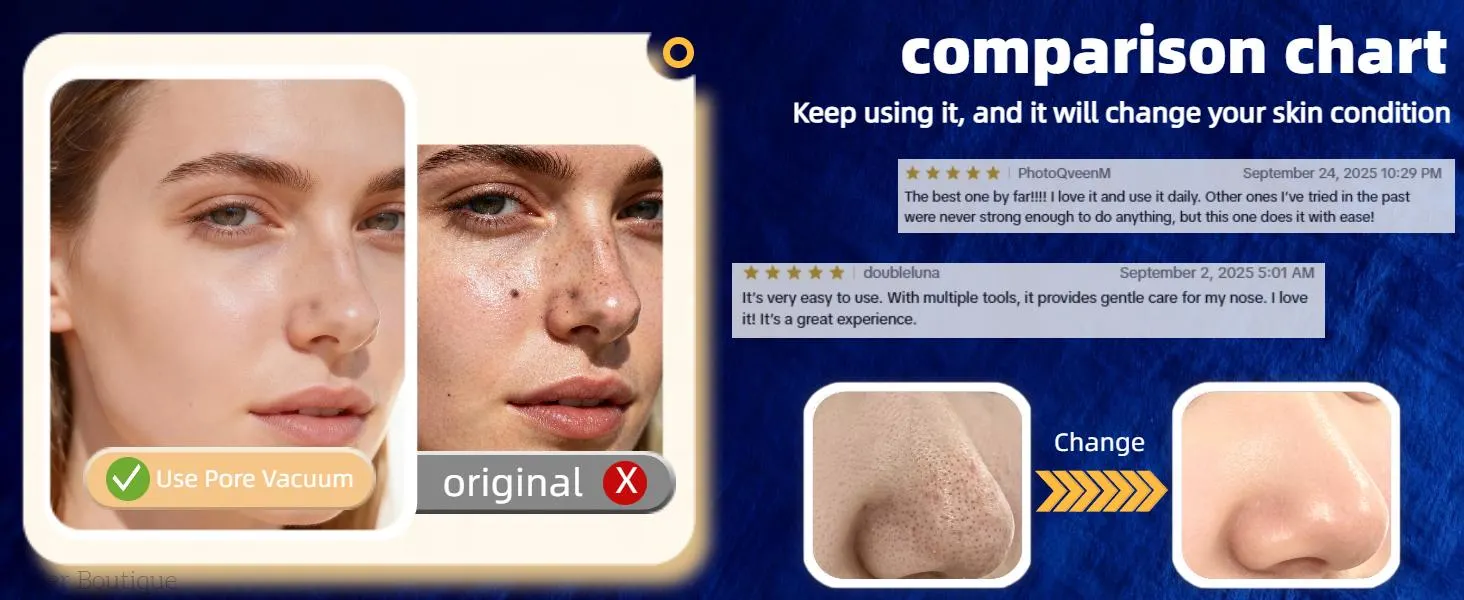Blackhead Remover Pore Vacuum USB Rechargeable Blackhead extractor Facial Beauty Instrument Facial Beauty Facial Cleaner Electric Acne Removal Tool Blackhead Remover Pore Vacuum USB Rechargeable Blackhead extractor Facial Beauty Instrument Facial Beauty Facial Cleaner Electric Acne Removal Tool