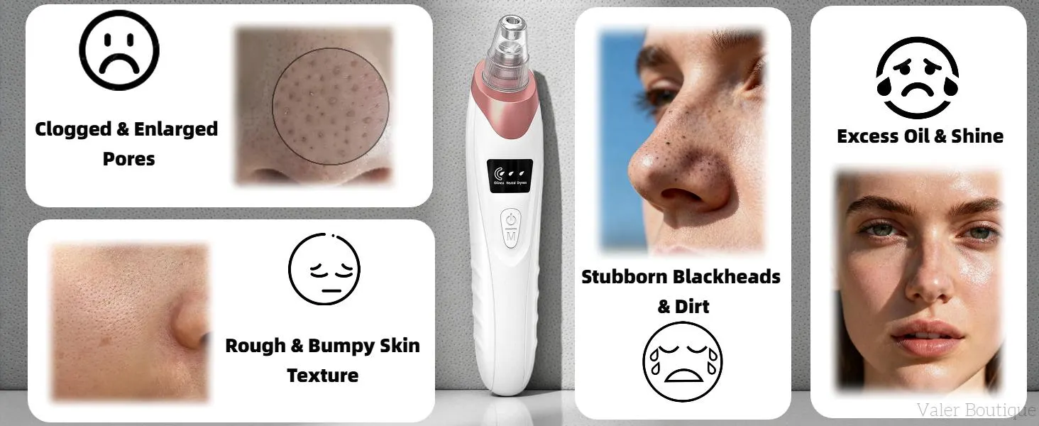 Blackhead Remover Pore Vacuum USB Rechargeable Blackhead extractor Facial Beauty Instrument Facial Beauty Facial Cleaner Electric Acne Removal Tool Blackhead Remover Pore Vacuum USB Rechargeable Blackhead extractor Facial Beauty Instrument Facial Beauty Facial Cleaner Electric Acne Removal Tool