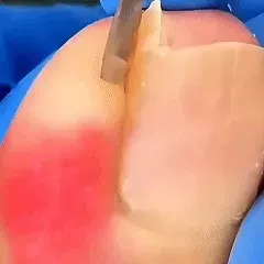 Slanted precision edge trimming a nail