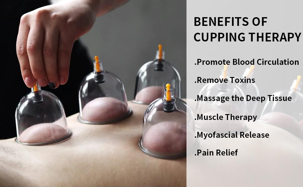 【FathersDayGift】Cupping Set, 6 Cups Cupping Kit for Massage Therapy, Chinese Cupping Therapy Set with Magnetics, Professional Vacuum Cupping Set for Cellulite Reduction Muscle Pain Relief with Manual Pump,dealsforyoudays,midyearsale