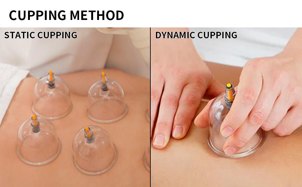 【FathersDayGift】Cupping Set, 6 Cups Cupping Kit for Massage Therapy, Chinese Cupping Therapy Set with Magnetics, Professional Vacuum Cupping Set for Cellulite Reduction Muscle Pain Relief with Manual Pump,dealsforyoudays,midyearsale