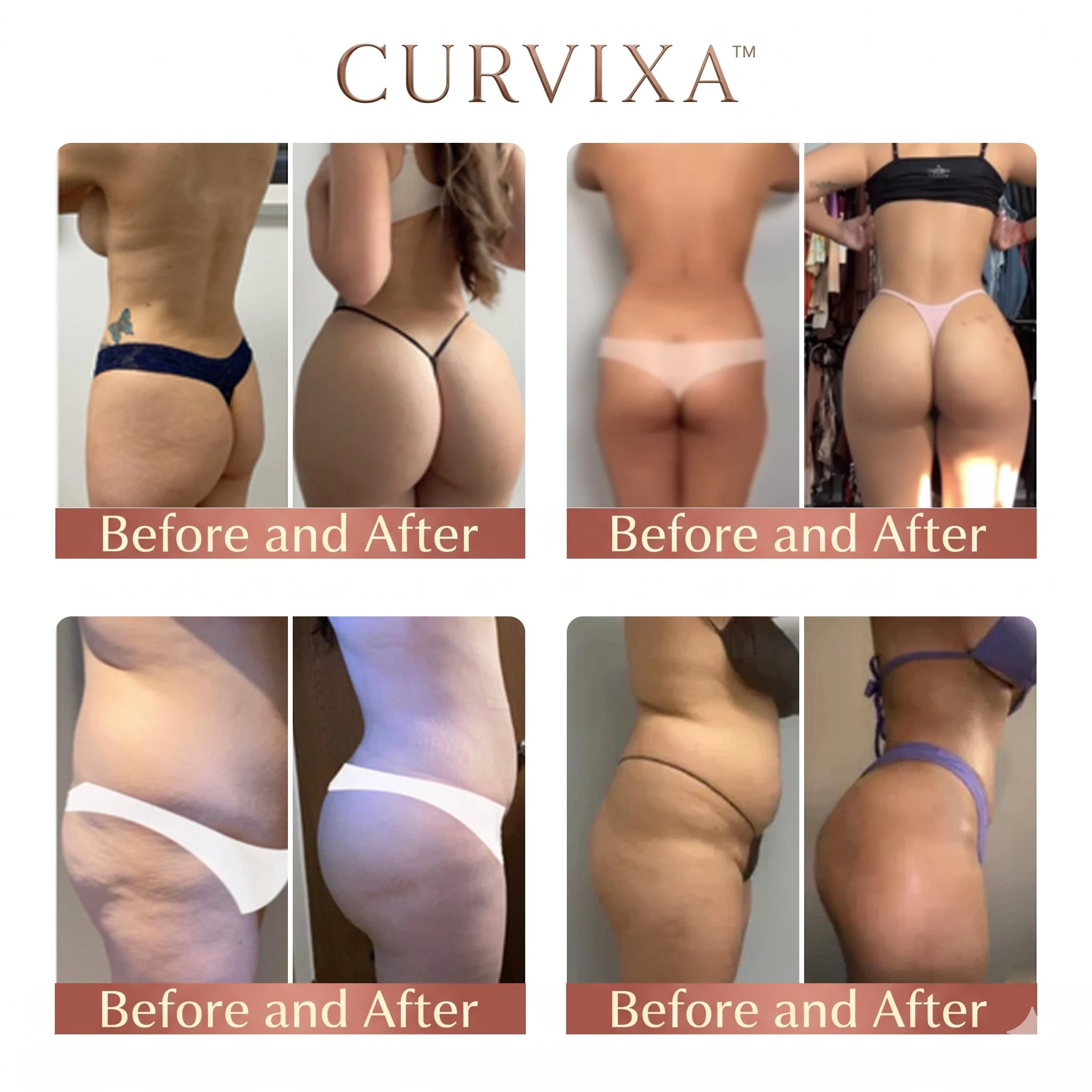 Curvixa™ CurveSculpt マイクロパッチ ✦ 下半身の曲線を整え、引き締め、なめらかに ✦ マイクロニードル浸透システム