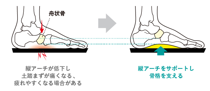 縦アーチをサポートし骨格を支える