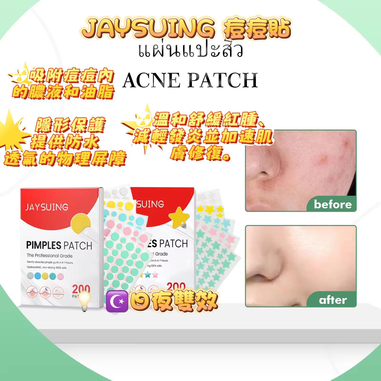 🌟 泰國 🇹🇭 Jaysuing 星星去痘貼 200 貼 🌟