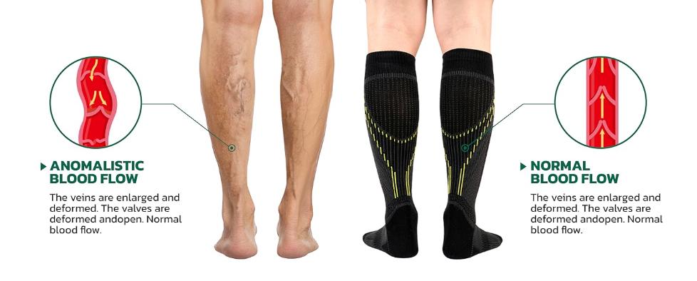 aoFIT EnergizeSox 压缩袜 - 适用于跑步、硬拉、防滑等运动的弹性压缩袜，户外跑步袜