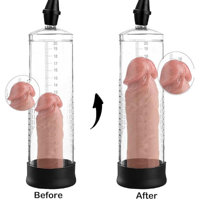 Vip20 Penis enlargement massage kit, male vacuum pump for erectile dysfunction