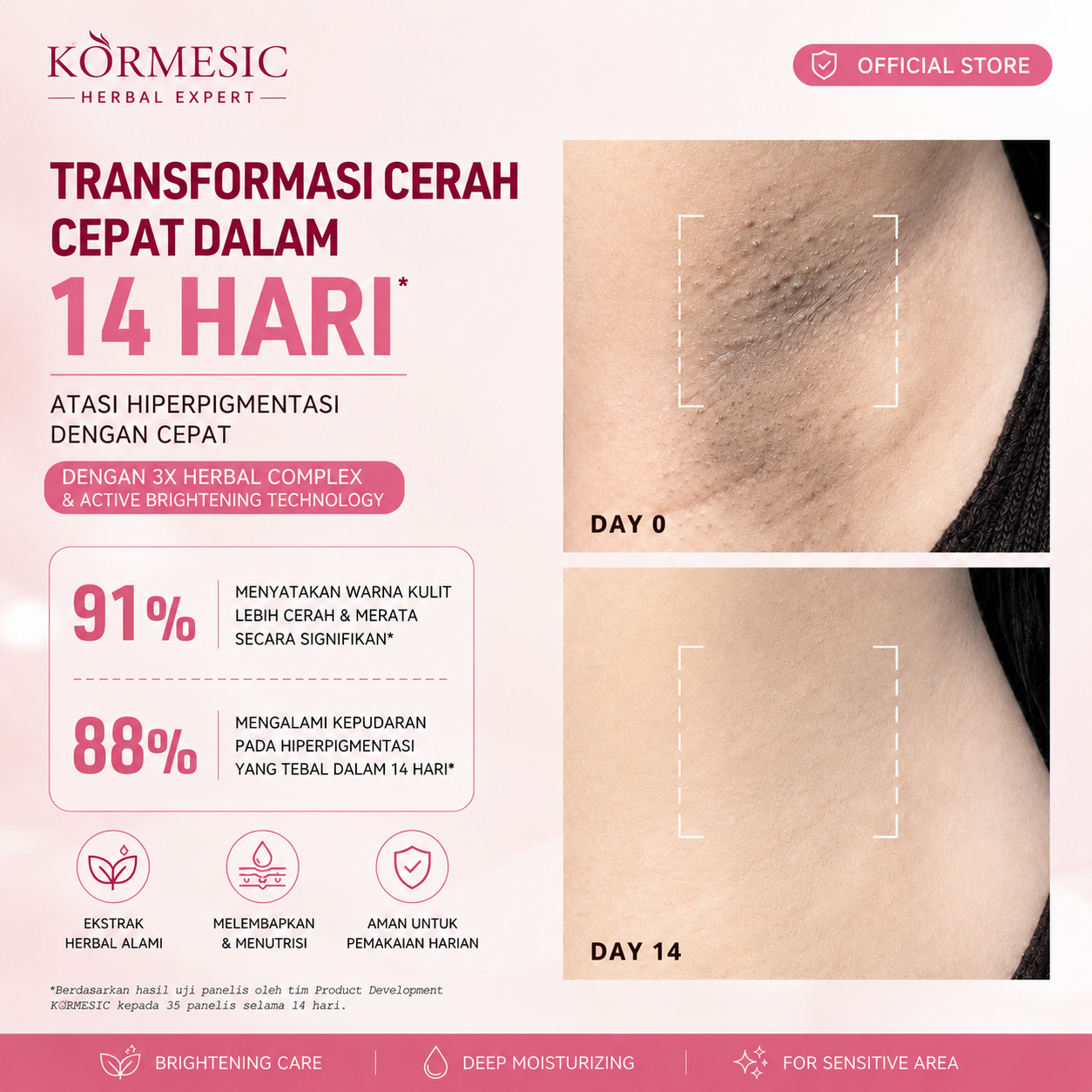 Kormesic Herbal Armpits Whitening Cream 50ml Krim Pemutih Kulit Tubuh Leher Ketiak Dan Selangkangan dan Miss V Pemutih Selangkangan BPOM