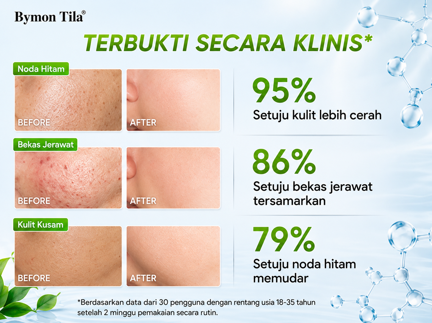 Kormesic 3X Acid Anti Acne Repairing and Moisturizing Cream 30ml - Untuk Kulit Berjerawat/Kering/Sensitif/Berminyak/Iritasi Ringan BPOM