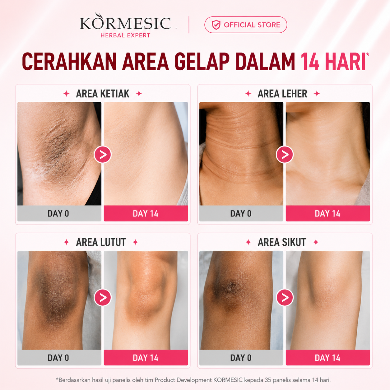 Kormesic Herbal Armpits Whitening Cream 50ml Krim Pemutih Kulit Tubuh Leher Ketiak Dan Selangkangan dan Miss V Pemutih Selangkangan BPOM
