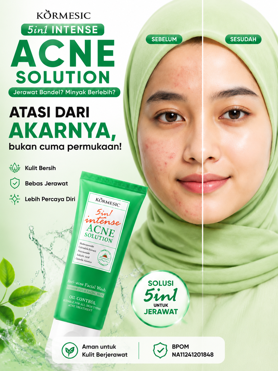 KORMESIC 5in1 Intense Acne Solution Facial Wash - Sabun Cuci Muka Anti Acne Pembersih Jerawat & Kontrol Minyak