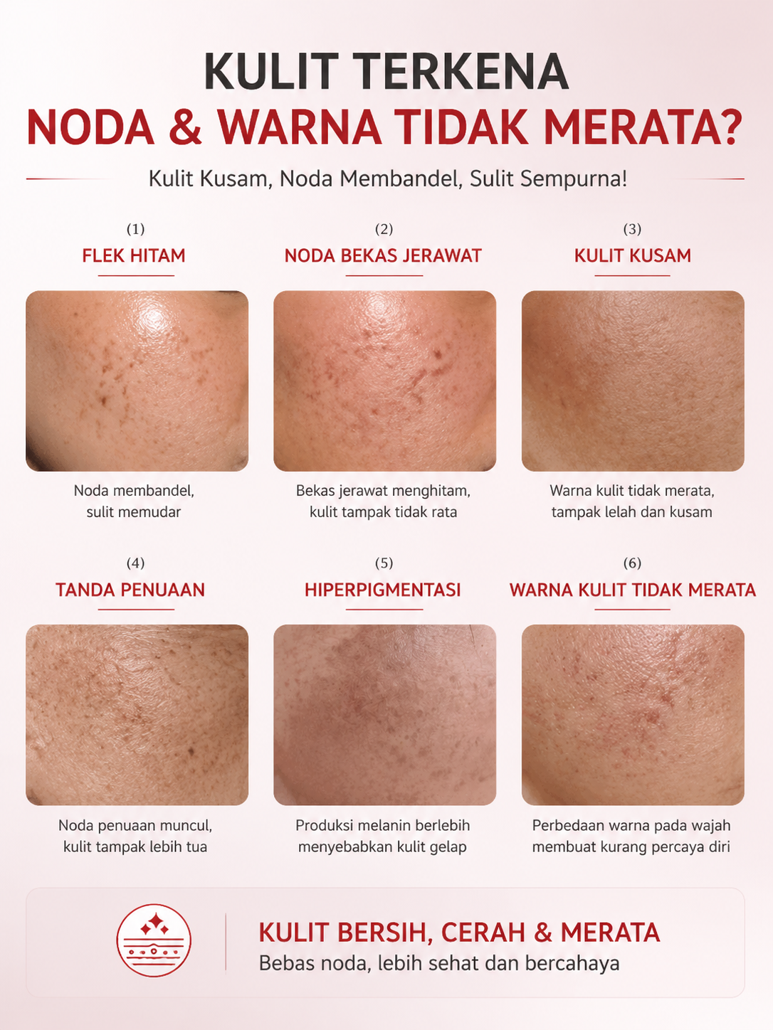 Krim Penghilang Flek Hitam Membandel & Bekas Jerawat - Whitening Spot Lightening Cream Niacinamide Alpha Arbutin AHA BHA BPOM Mencerahkan Kulit Kusam