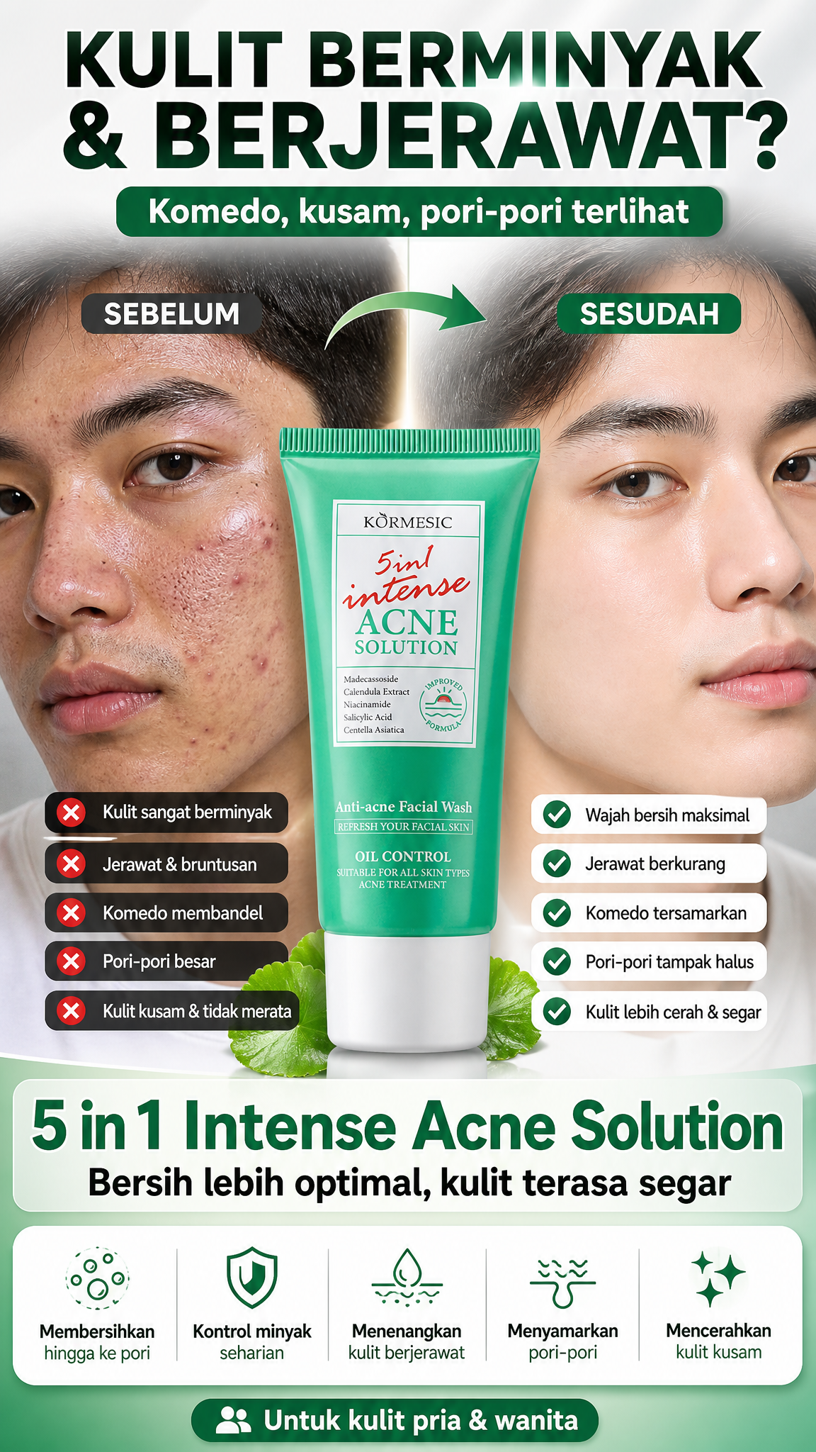 KORMESIC 5in1 Intense Acne Solution Facial Wash - Sabun Cuci Muka Anti Acne Pembersih Jerawat & Kontrol Minyak