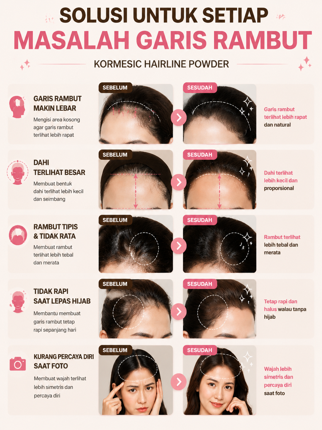 KORMESIC Hairline Powder - Bedak Penutup Rambut Tipis Rambut Botak Kosmetik Hijab Tahan Air & Keringat Waterproof Long Lasting Natural Black