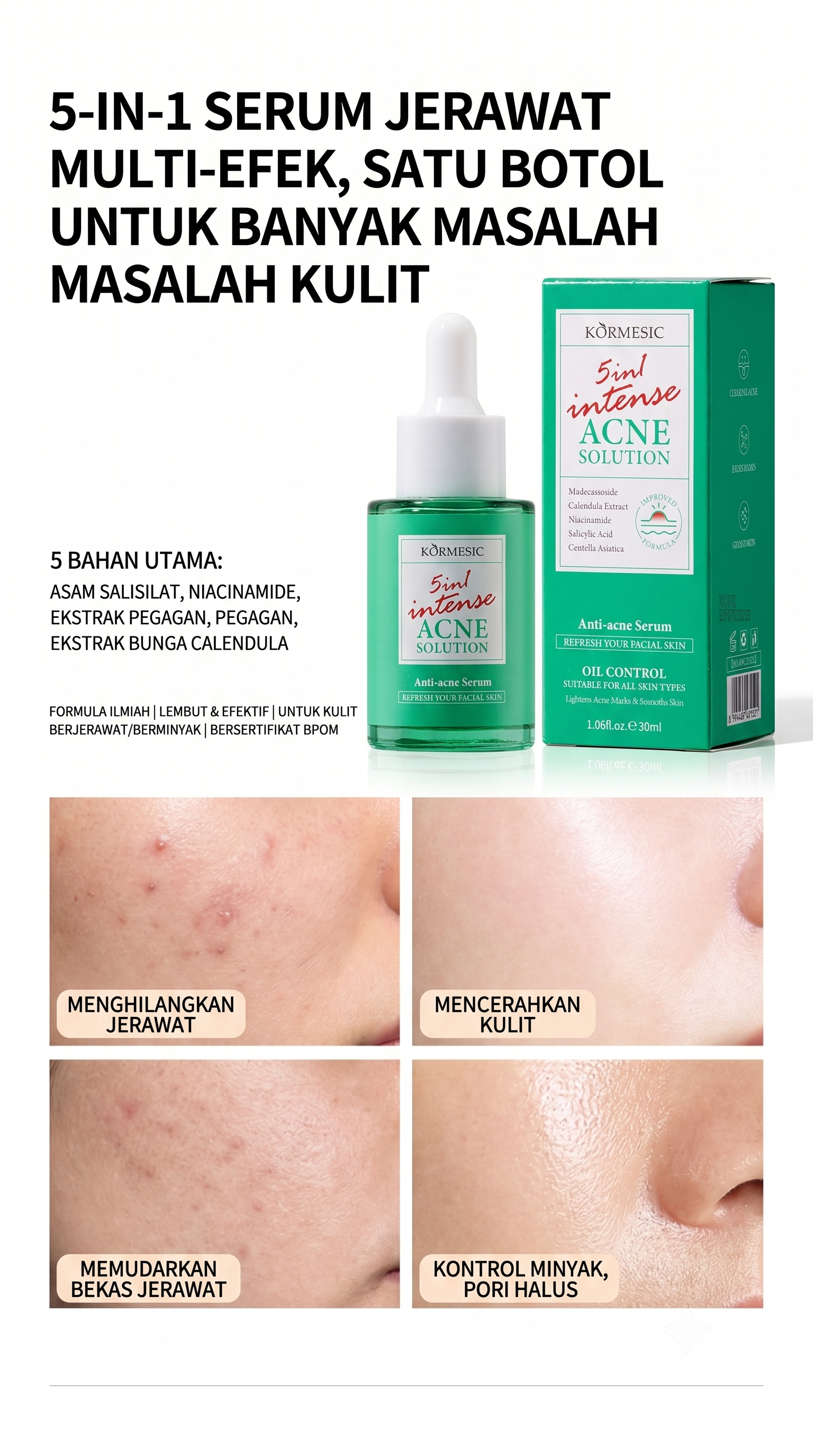 KORMESIC 5in1 Intense Acne Solution Serum - Serum Anti Acne Penghilang Jerawat & Bekas Jerawat