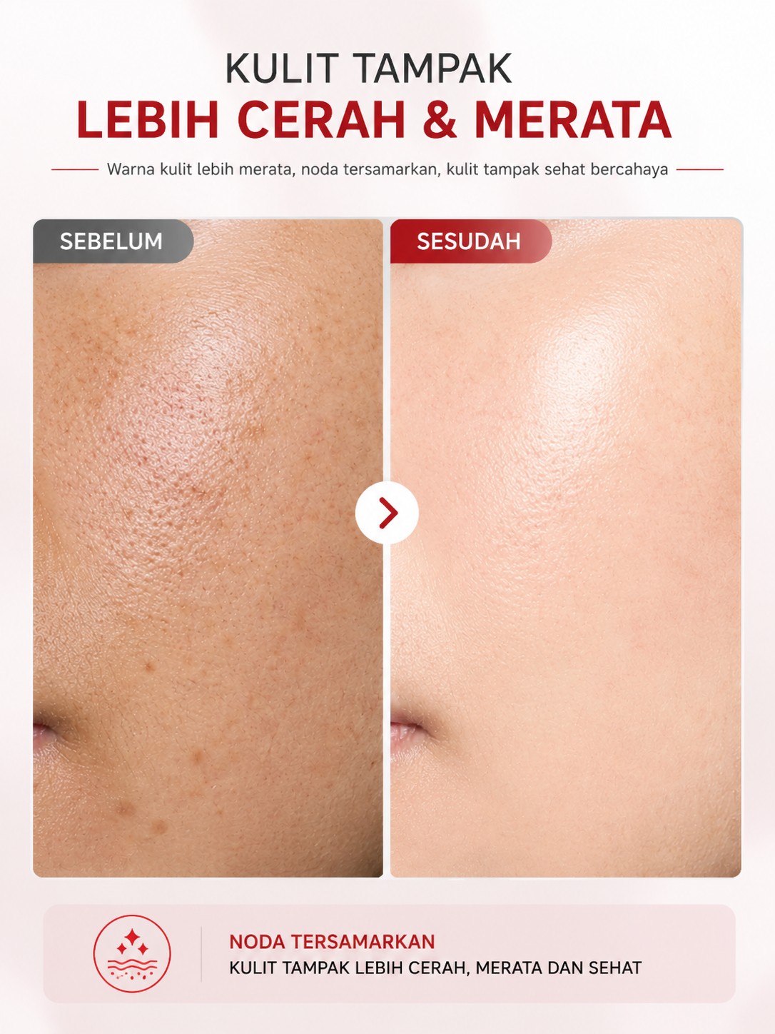 Krim Penghilang Flek Hitam Membandel & Bekas Jerawat - Whitening Spot Lightening Cream Niacinamide Alpha Arbutin AHA BHA BPOM Mencerahkan Kulit Kusam