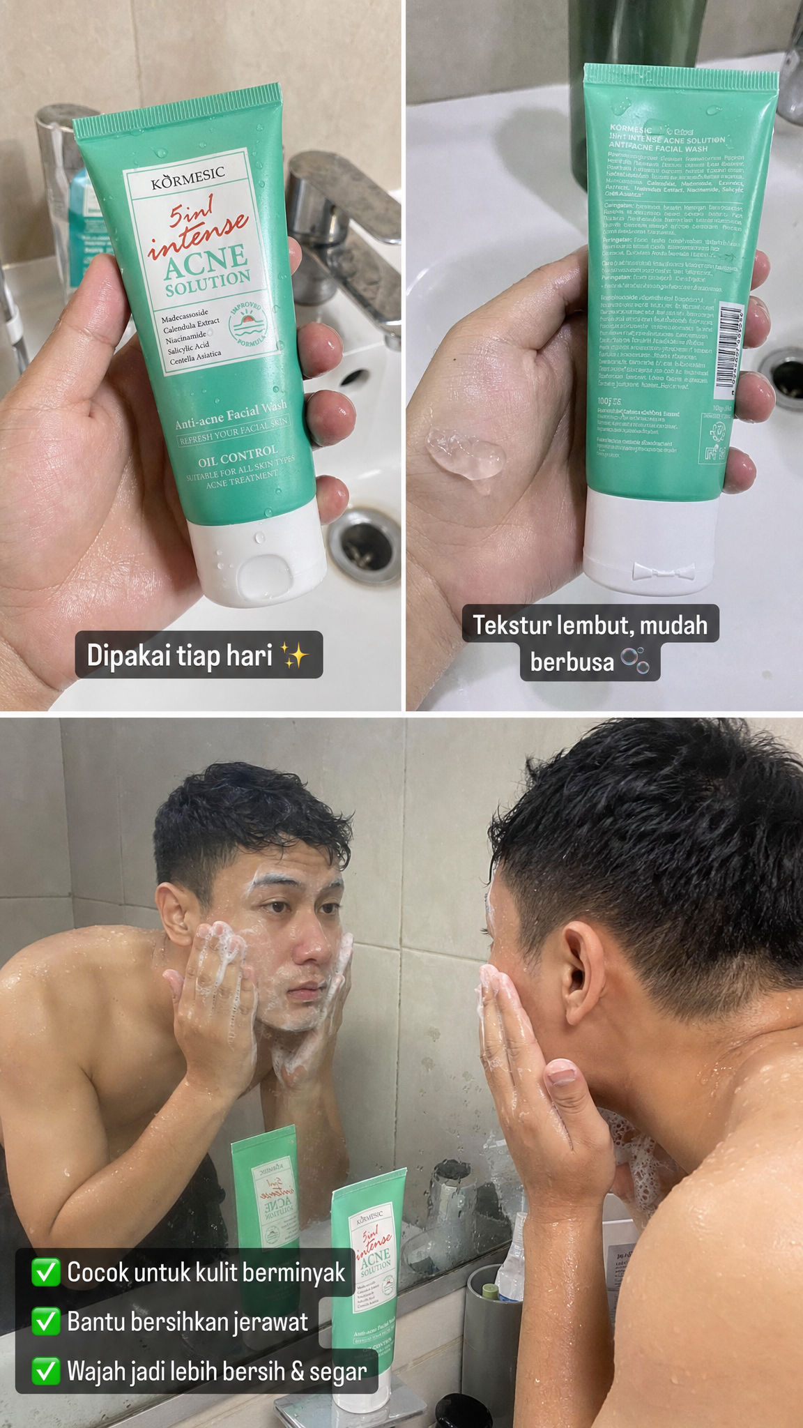 KORMESIC 5in1 Intense Acne Solution Facial Wash - Sabun Cuci Muka Anti Acne Pembersih Jerawat & Kontrol Minyak