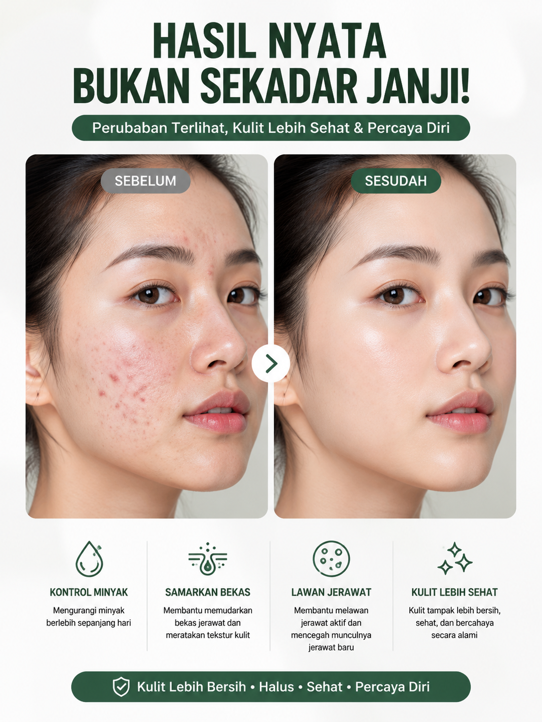 KORMESIC 5in1 Intense Acne Solution Serum - Serum Anti Acne Penghilang Jerawat & Bekas Jerawat