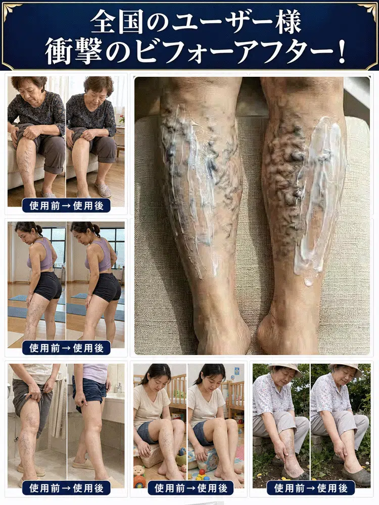 腿部舒緩護理凝膠｜清爽按摩，日常呵護雙腿