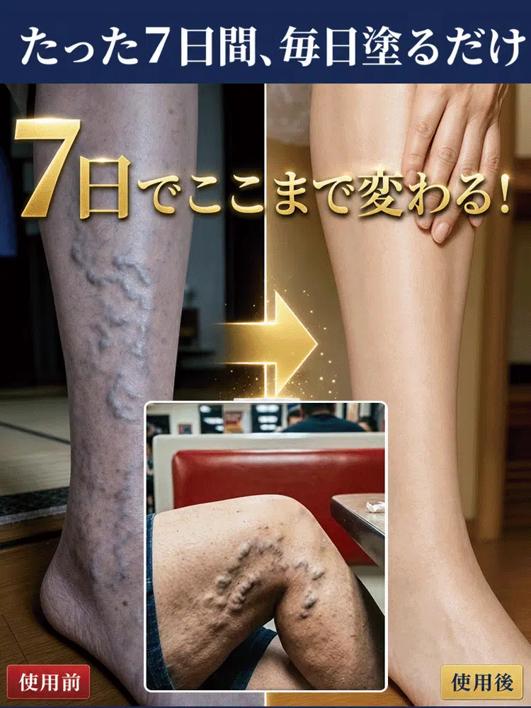 腿部舒緩護理凝膠｜清爽按摩，日常呵護雙腿