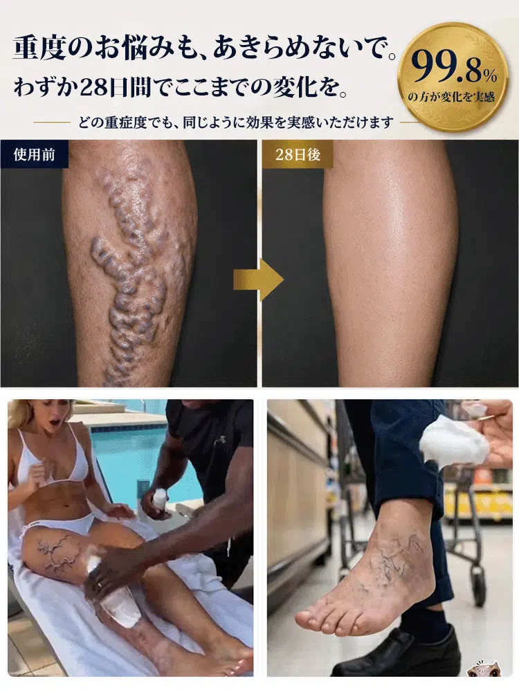 腿部舒緩護理凝膠｜清爽按摩，日常呵護雙腿