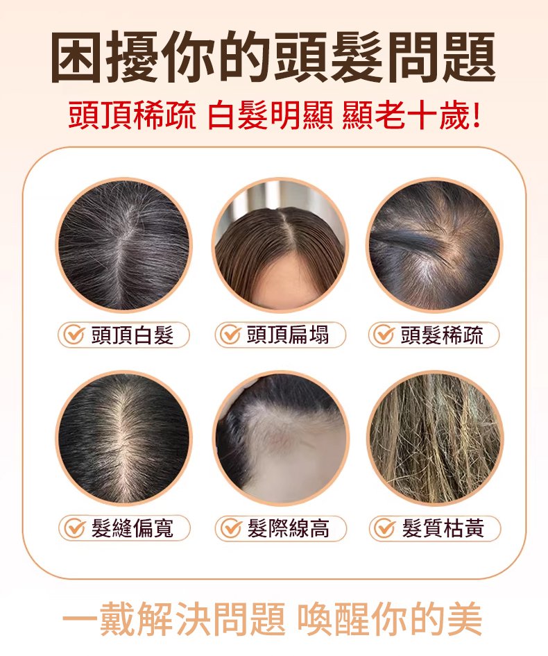 翻译件-SL-【无需发卡】全真发修颜补发片-颅顶作弊器-1349914-系统_01.jpg