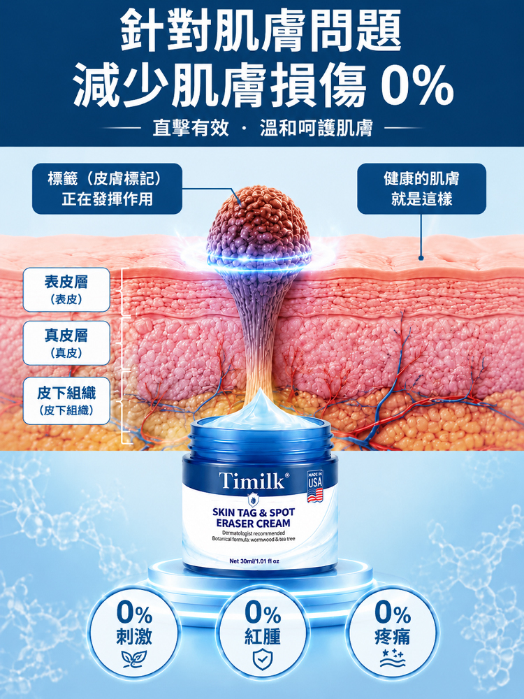 皮膚疣斑點去除霜