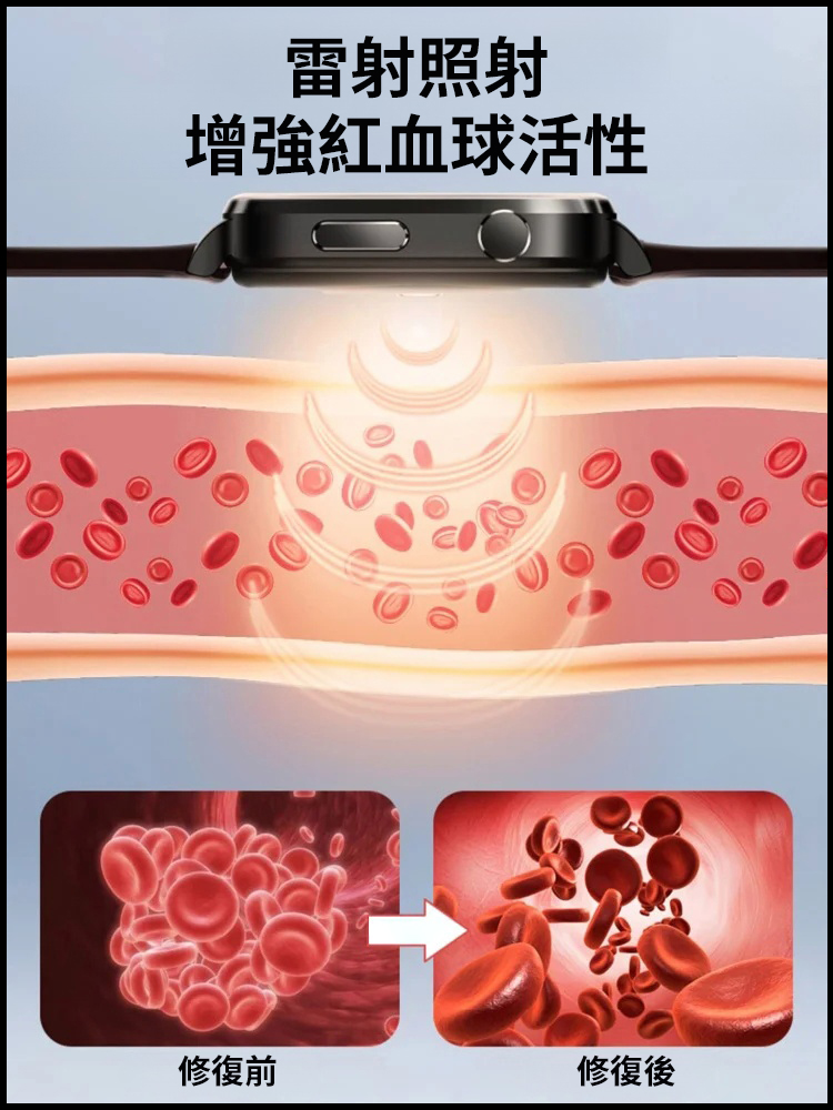 智慧型無創血糖尿酸手錶