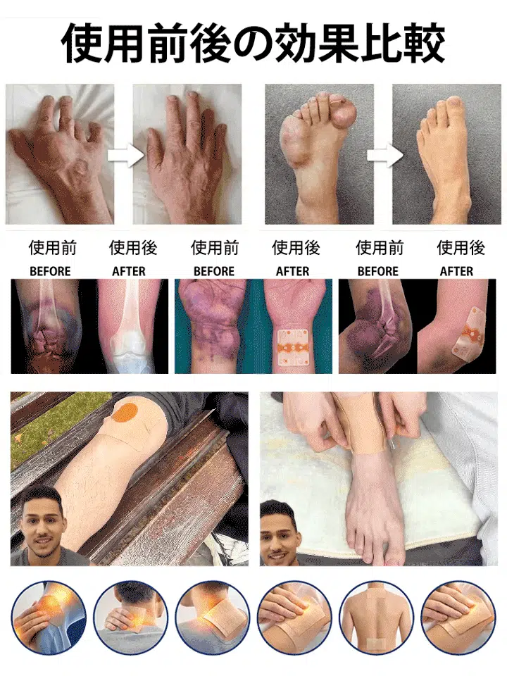 【全国の薬局・ドラッグストアで10年連続売上No.1】魔法の貼るお灸