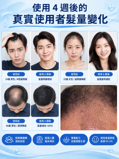 【頭皮復原年輕】生髮修護滾珠精油
