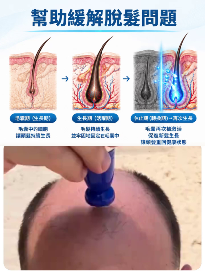 【頭皮復原年輕】生髮修護滾珠精油