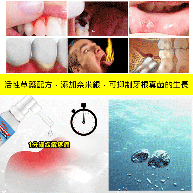 X22112201L-牙痛寧痛立停噴劑