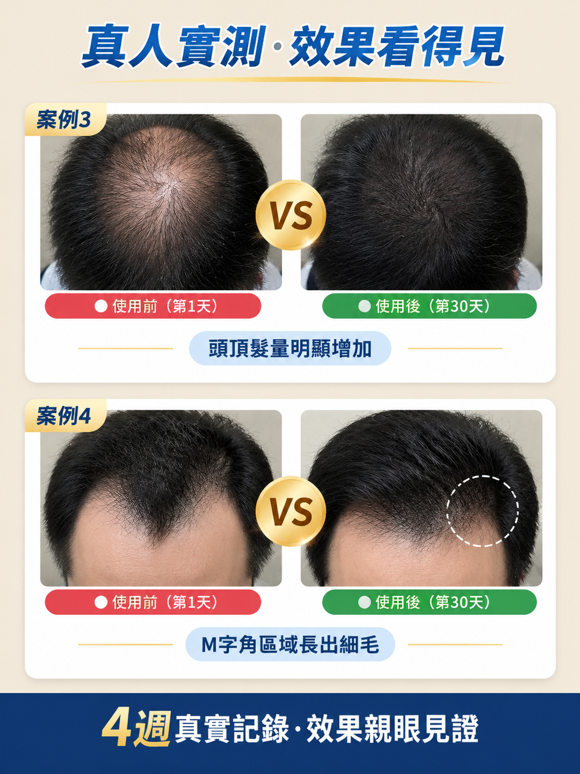 详情5.png