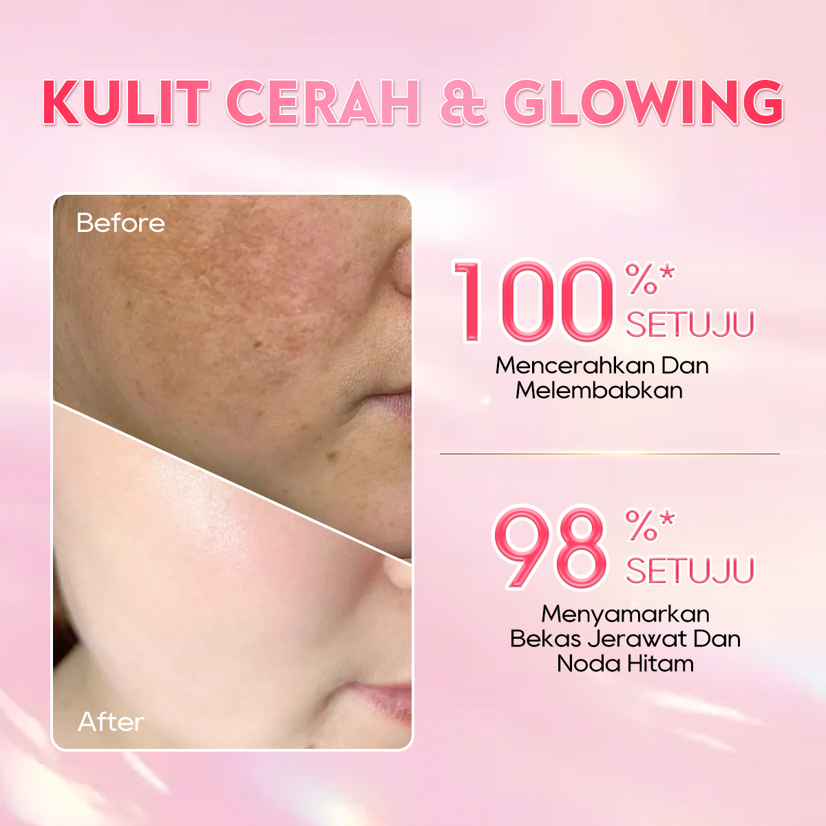 [CHALONESE] Brightening Cream BPOM Membantu Mencerahkan Kulit Wajah dan Membuat Wajah Lebih Lembab