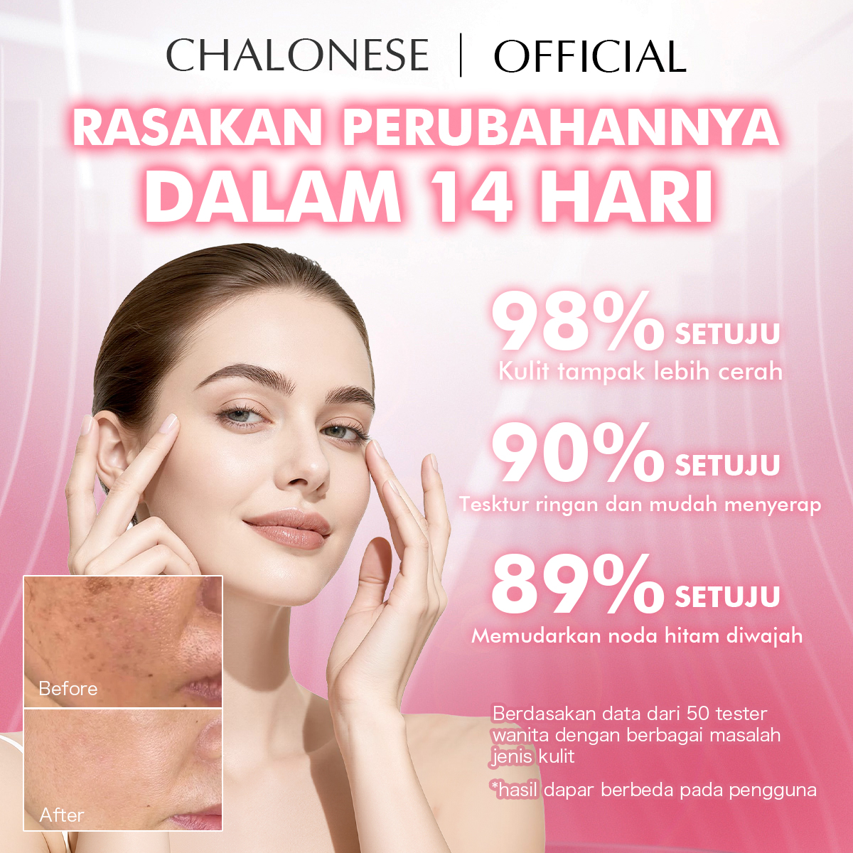 [CHALONESE] Brightening Cream BPOM Membantu Mencerahkan Kulit Wajah dan Membuat Wajah Lebih Lembab