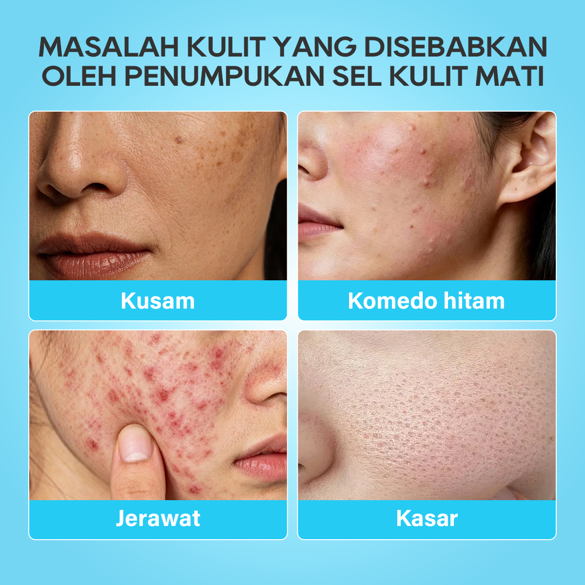 [CHALONESE] Exfoliating Gel Mengangkat Sel Kulit Mati Dan Kotoran Secara Mendalam Dengan Pijatan Lembut Ke Seluruh Area Wajah Sehingga Kulit Tampak Lebih Halus Dan Cerah