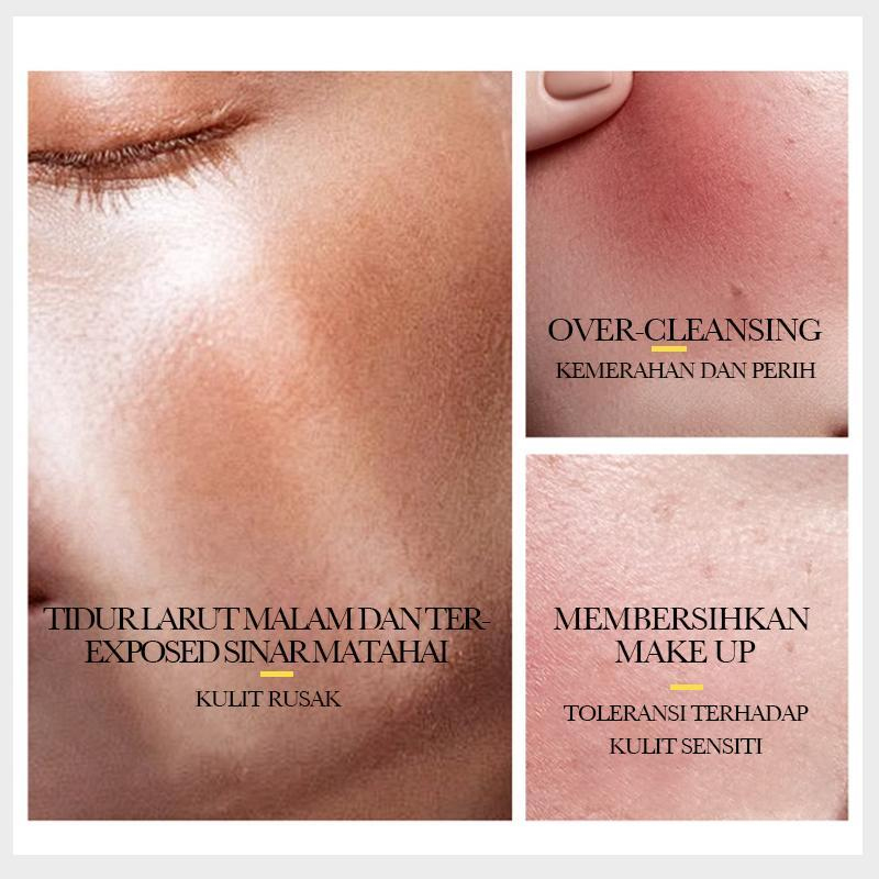 NEW CHALONESE Gentle Cleanser 100g – Brightening Acne Oil Control Facial Wash, Pembersih Wajah Harian untuk Membantu Membersihkan Kotoran, Minyak Berlebih dan Menjaga Kelembapan Kulit