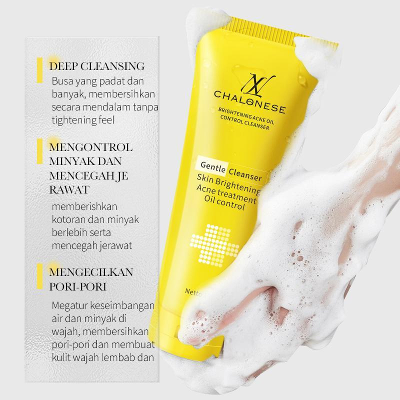 NEW CHALONESE Gentle Cleanser 100g – Brightening Acne Oil Control Facial Wash, Pembersih Wajah Harian untuk Membantu Membersihkan Kotoran, Minyak Berlebih dan Menjaga Kelembapan Kulit
