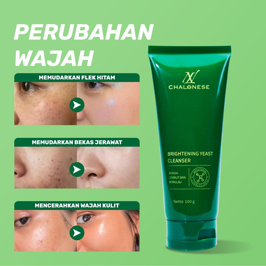 Chalonese Brightening Yeast Cleanser Skin Barrier Gel – Pembersih Wajah Lembut untuk Membantu Membersihkan Kotoran, Menjaga Kelembapan, Merawat Skin Barrier, Mencerahkan Kulit, dan Membuat Kulit Tampak Lebih Bersih, Sehat, Lembut Setiap Hari