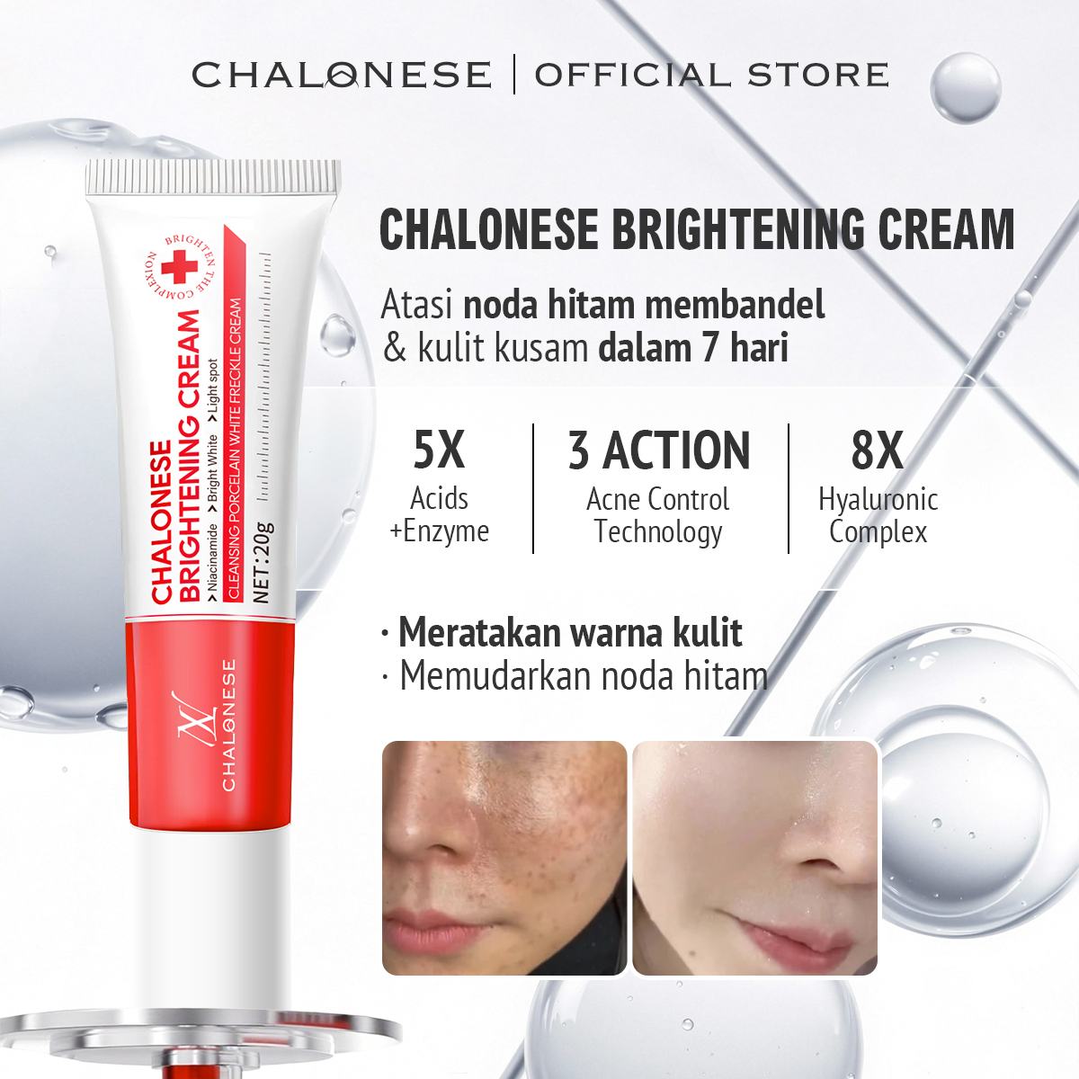 [CHALONESE] Brightening Cream BPOM Membantu Mencerahkan Kulit Wajah dan Membuat Wajah Lebih Lembab