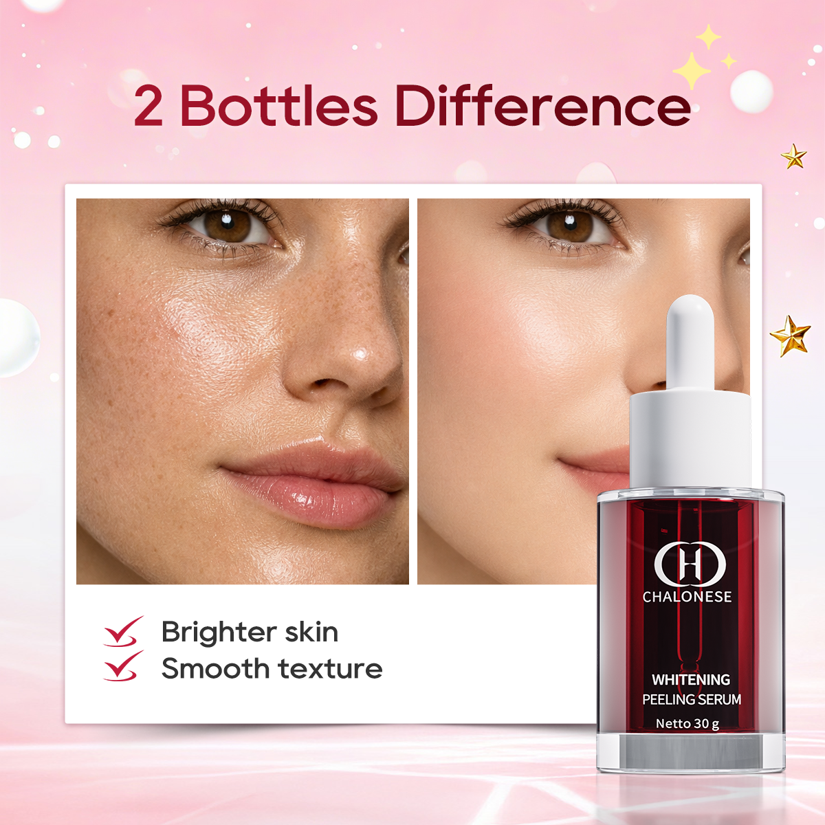【KOL CHOICE2】Chalonesse Whitening Peeling Serum 12% Acid – Solusi Kulit Lebih Cerah, Halus, dan Glowing dalam Perawatan Intensif dengan Formula Lembut untuk Semua Jenis Kulit